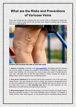 what are the risks and preventions of varicose
