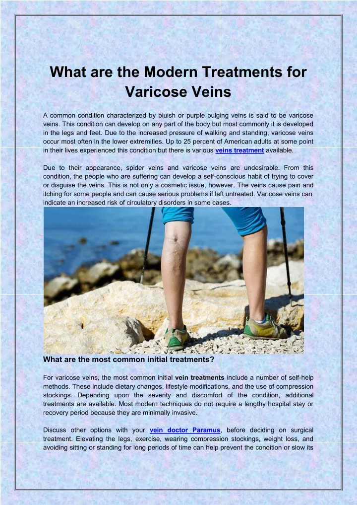 what are the modern treatments for varicose veins