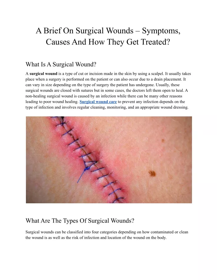 a brief on surgical wounds symptoms causes