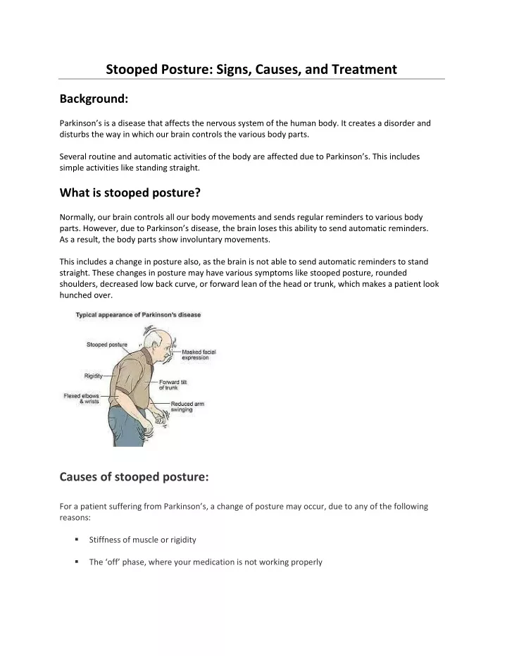 stooped posture signs causes and treatment