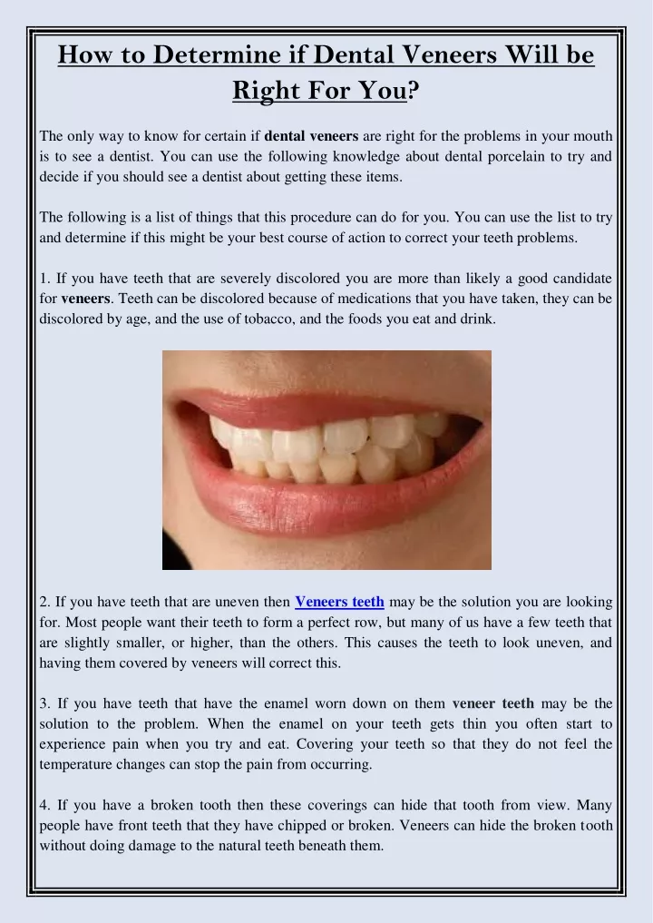 how to determine if dental veneers will be right