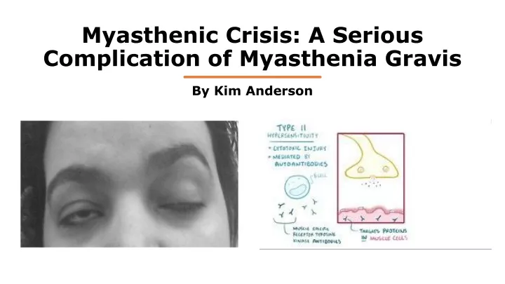 myasthenic crisis a serious complication of myasthenia gravis