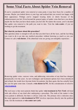 Some Vital Facts About Spider Vein Removal