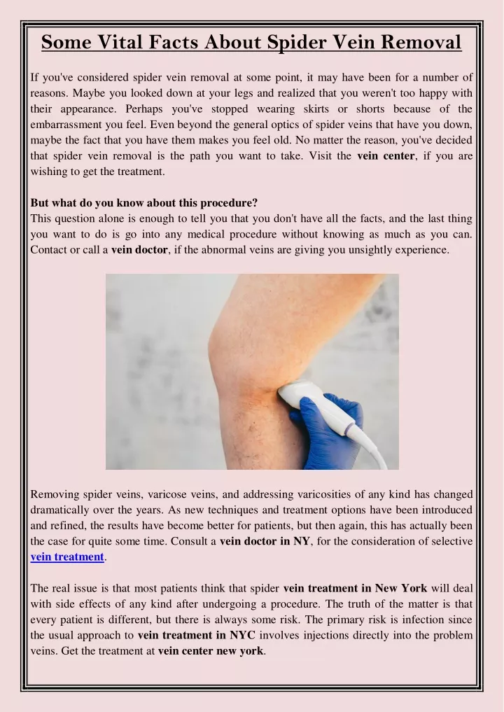 some vital facts about spider vein removal