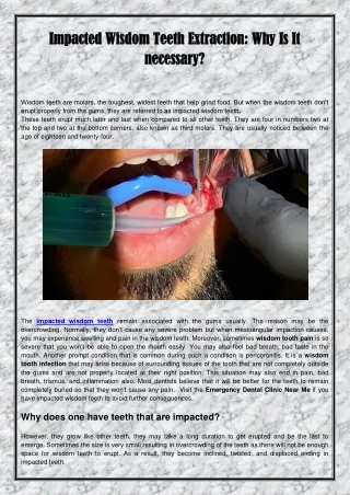 impacted wisdom teeth extraction