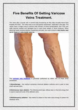 Five Benefits Of Getting Varicose Veins Treatment.