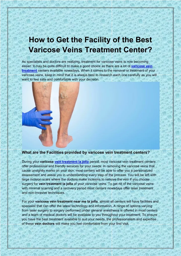 how to get the facility of the best varicose