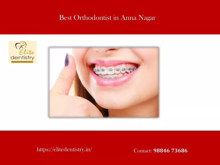 best orthodontist in anna nagar