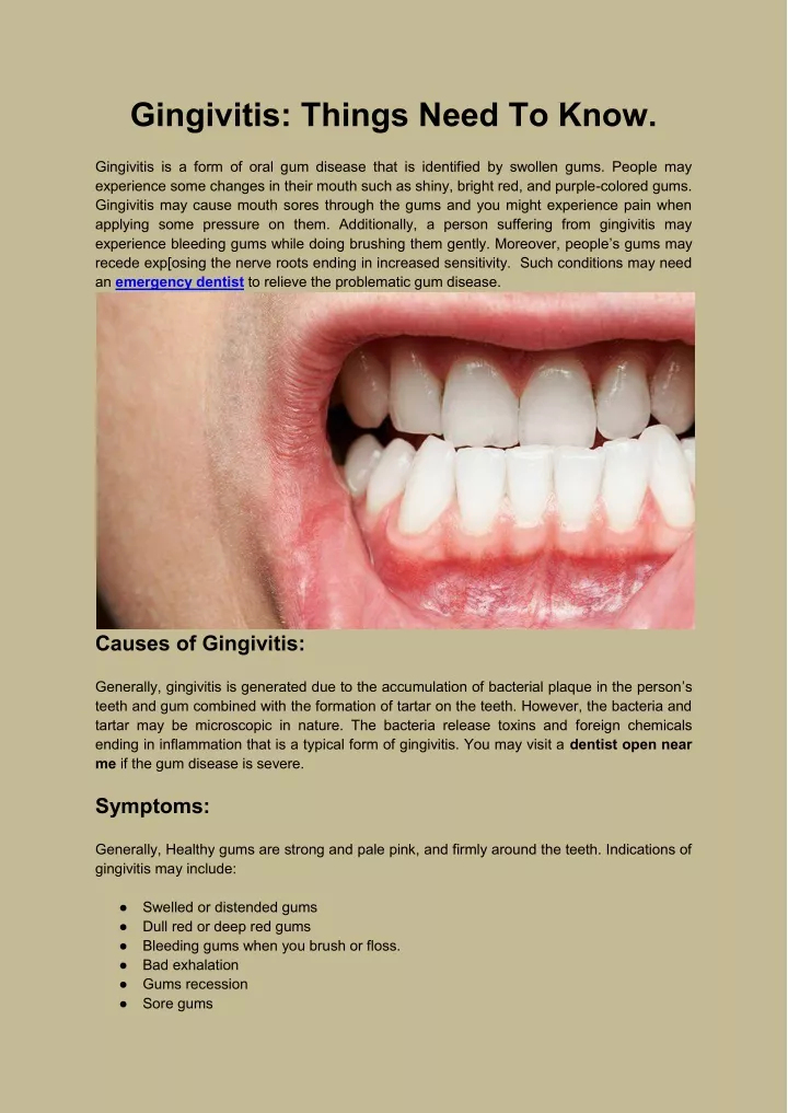 gingivitis things need to know