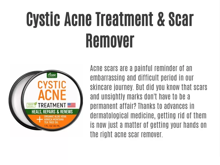 cystic acne treatment scar remover