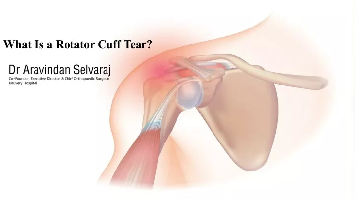 what is a rotator cuff tear