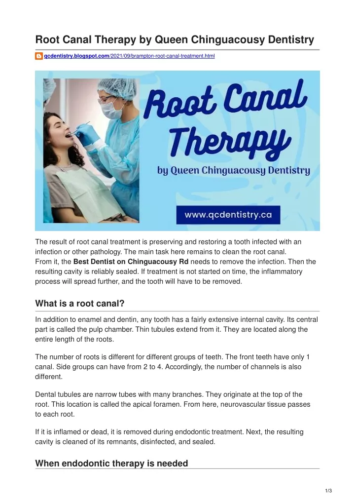 root canal therapy by queen chinguacousy dentistry