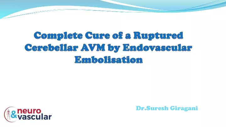 complete cure of a ruptured cerebellar avm by endovascular embolisation