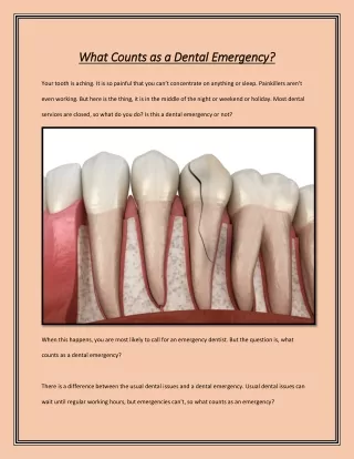 What Counts as a Dental Emergency