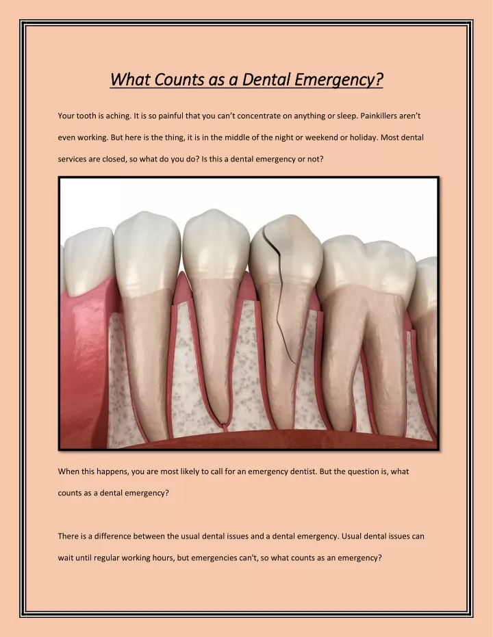 what counts as a dental emergency what counts