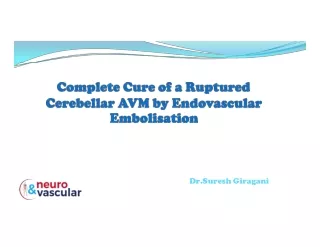 Complete cure of a ruptured cerebellar AVM by endovascular embolisation.
