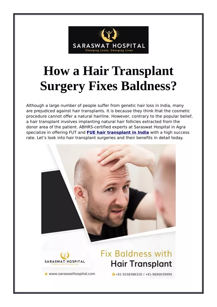 how a hair transplant surgery fixes baldness