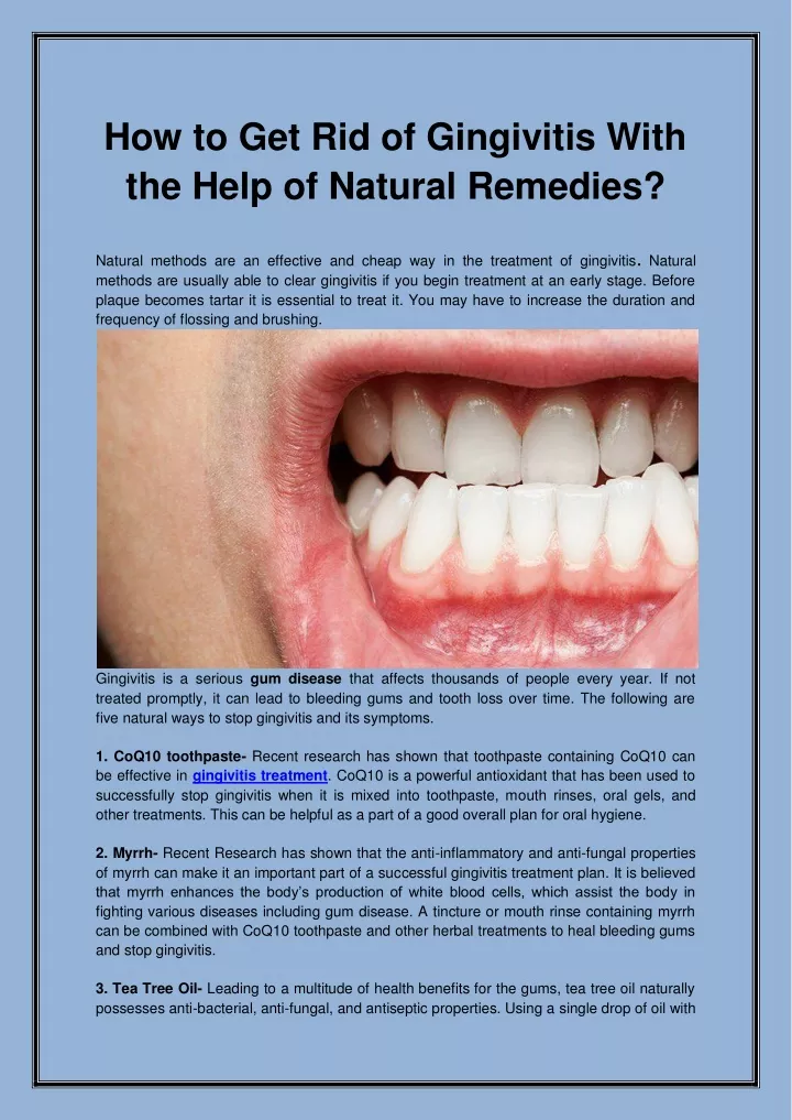 how to get rid of gingivitis with the help