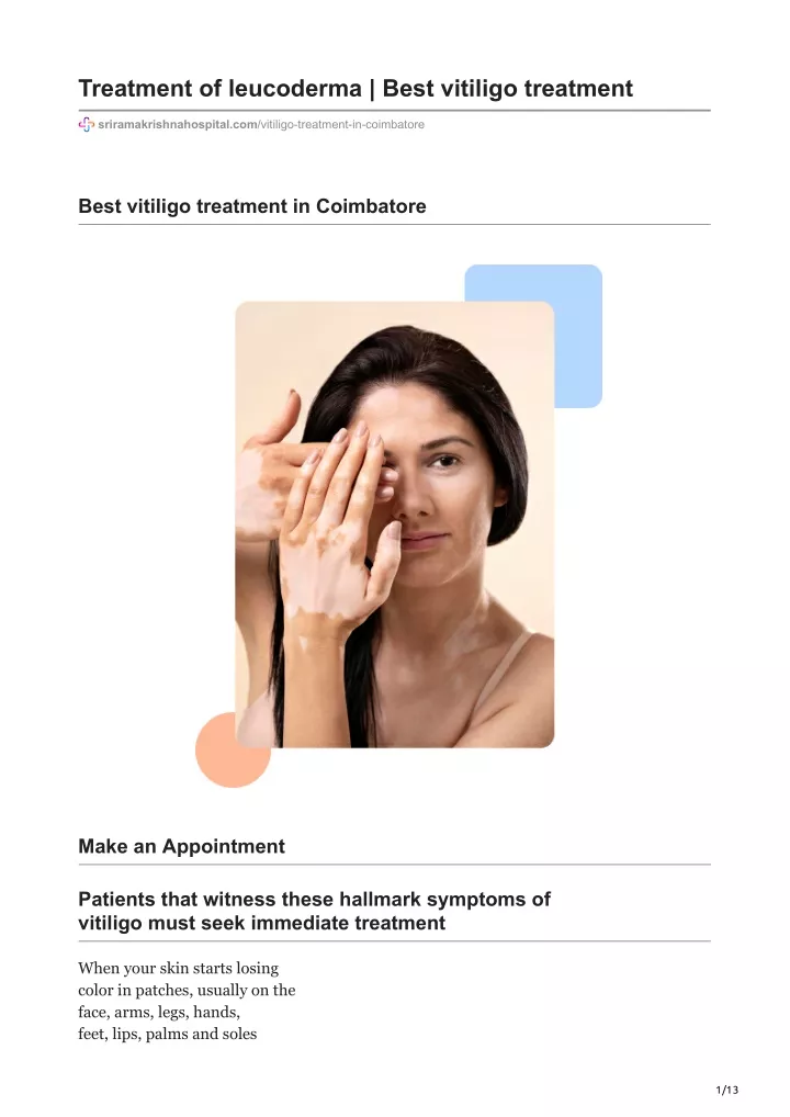 treatment of leucoderma best vitiligo treatment