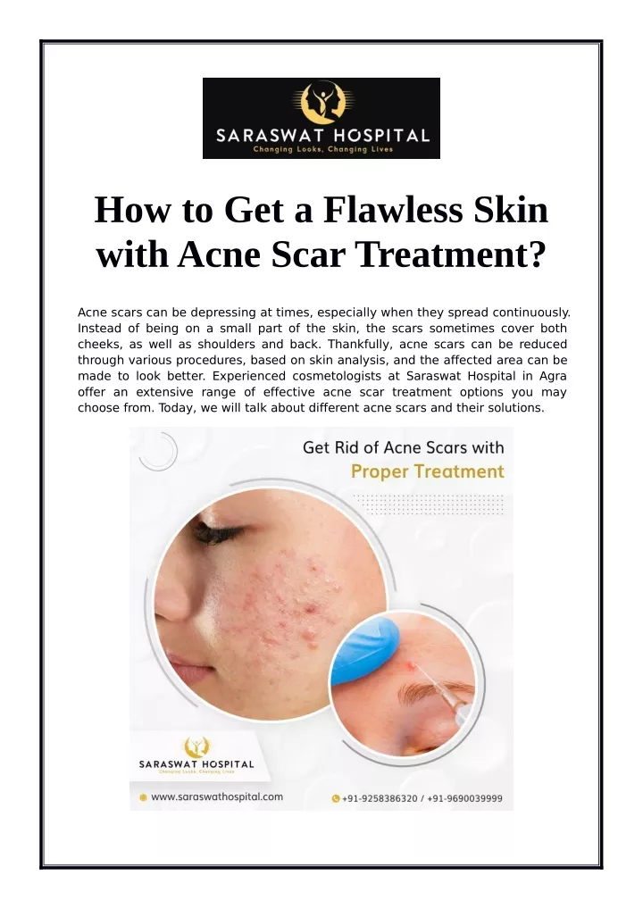 how to get a flawless skin withacne scar treatment