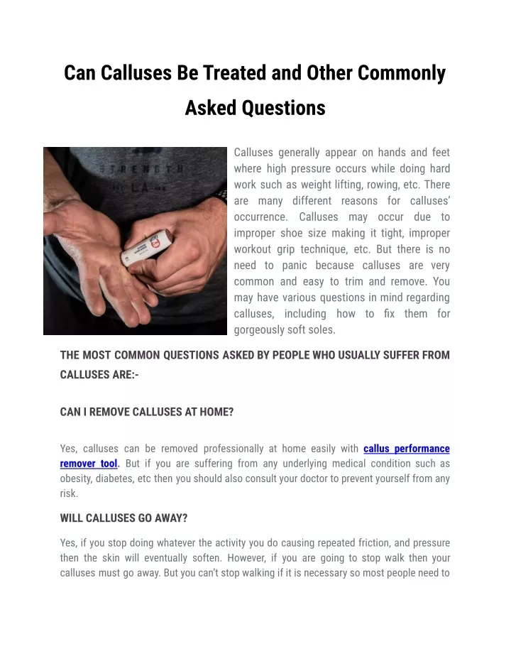 can calluses be treated and other commonly