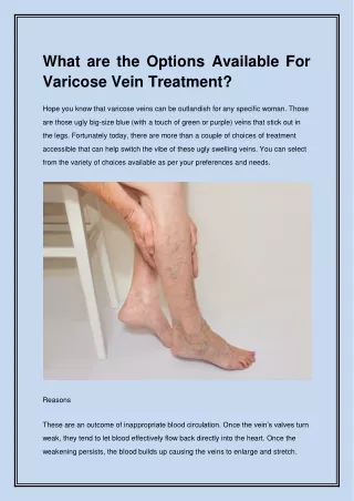 What are the Options Available For Varicose Vein Treatment