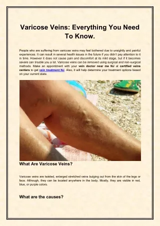 Varicose Veins Everything You Need To Know.