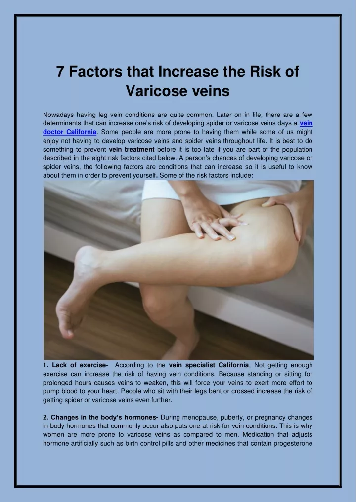 7 factors that increase the risk of varicose veins