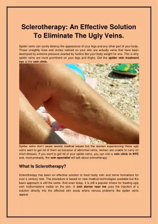 Sclerotherapy An Effective Solution To Eliminate The Ugly Veins.