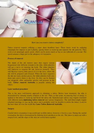 Tattoo removal Australia