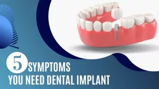 5 Symptoms You Need Dental Implant