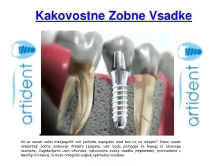 kakovostne zobne vsadke