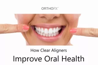 How Clear Aligners Improve Oral Health | Good Oral Hygiene