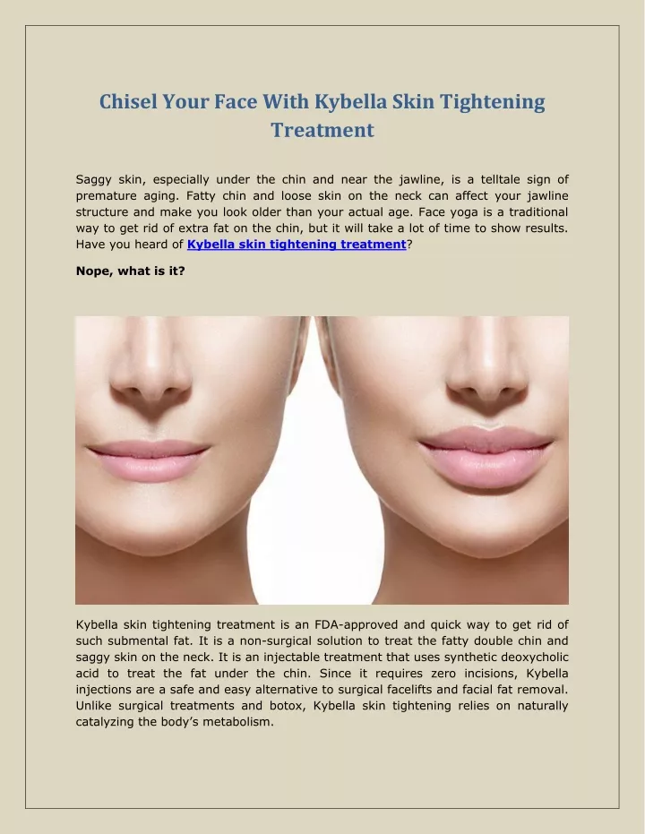 chisel your face with kybella skin tightening