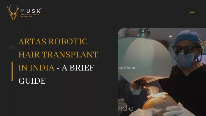 artas robotic hair transplant in india a brief