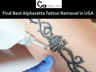 Find Best Alpharetta Tattoo Removal in USA