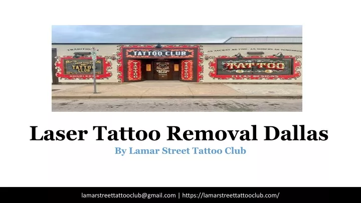 laser tattoo removal dallas by lamar street