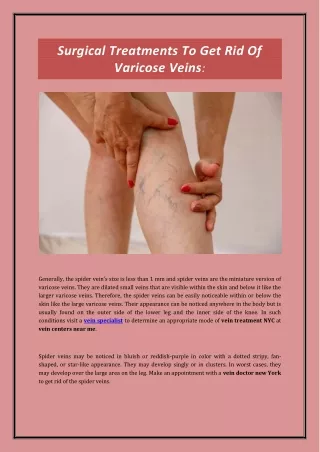 Surgical Treatments To Get Rid Of Varicose Veins