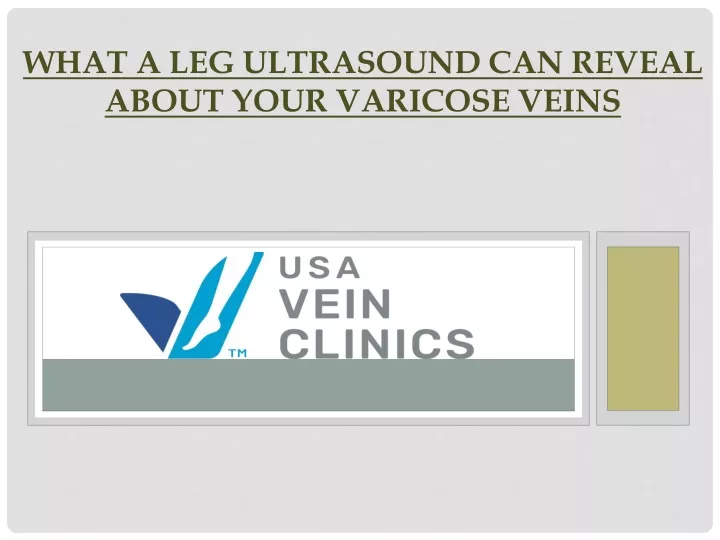 what a leg ultrasound can reveal about your varicose veins