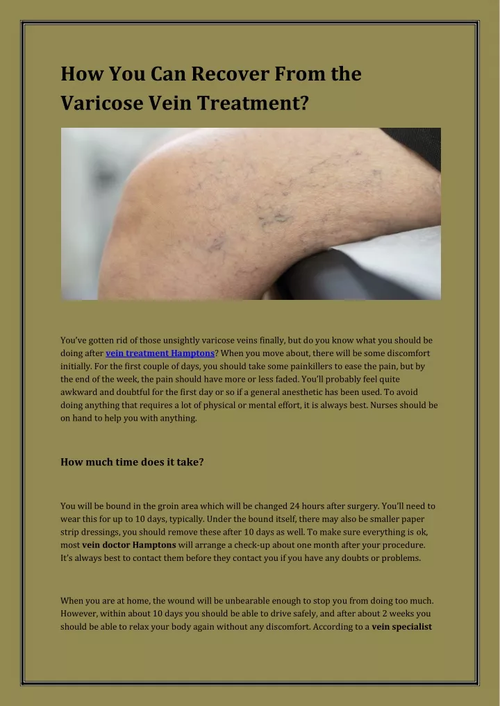 how you can recover from the varicose vein