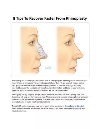 8 Tips To Recover Faster From Rhinoplasty - Dr. Viral Desai