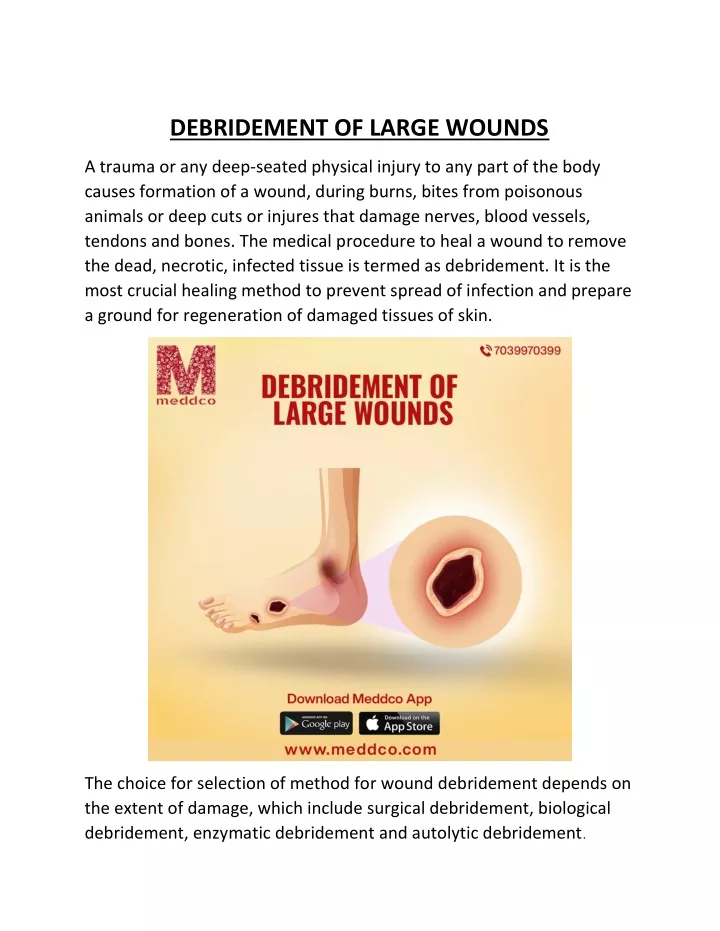 debridement of large wounds