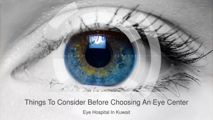 things to consider before choosing an eye center