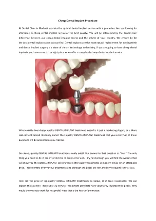 Tooth Implant Cost in Madurai