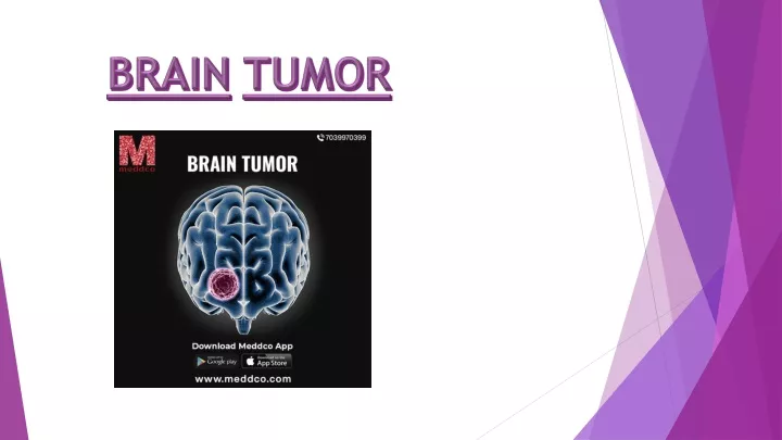 brain tumor