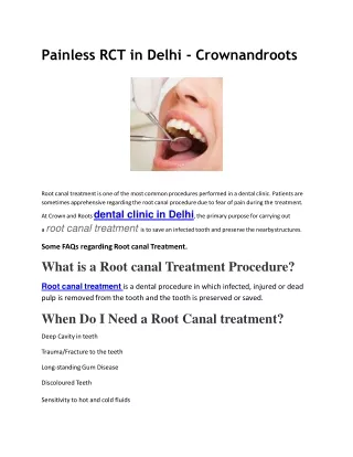 Painless RCT in Delhi - Crownandroots