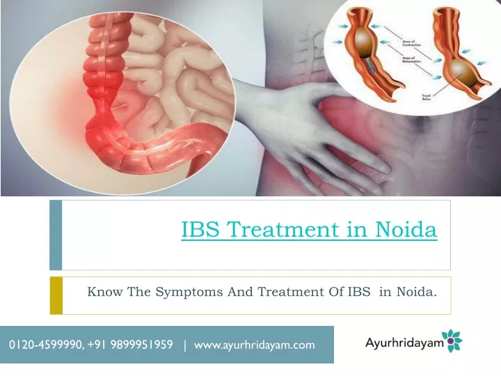 ibs treatment in noida