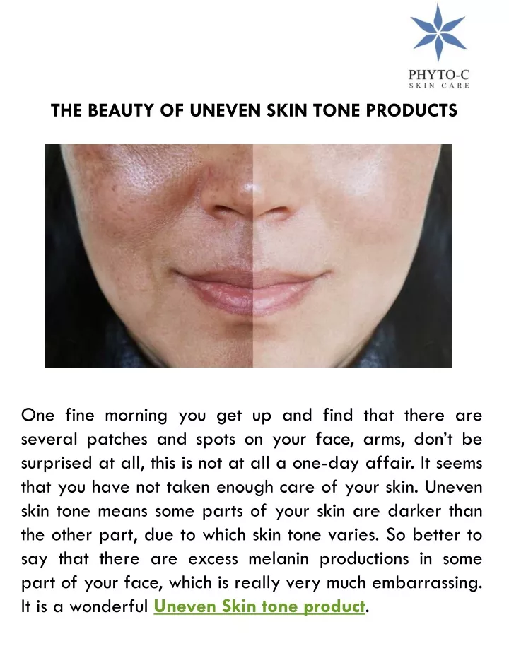 the beauty of uneven skin tone products
