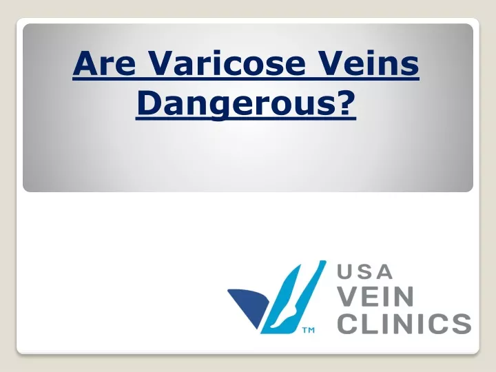 are varicose veins dangerous