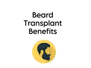 Beard Transplant Benefits